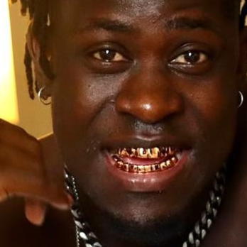 Factors About Gold Teeth