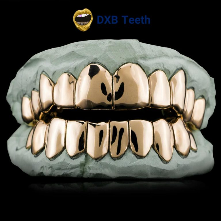 How Grillz Are Made – Behind the Scenes with a Dentist