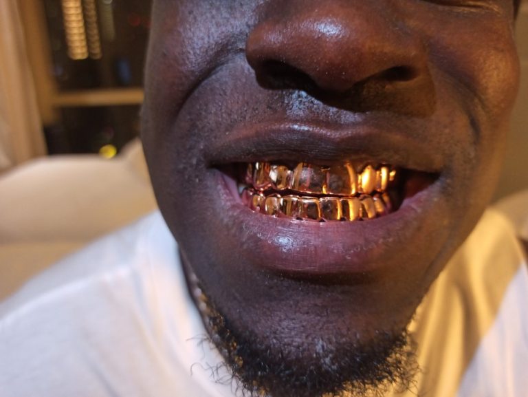 Rose Gold 18 Karrat Custom Best Grillz