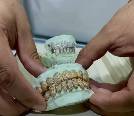 History of Grillz