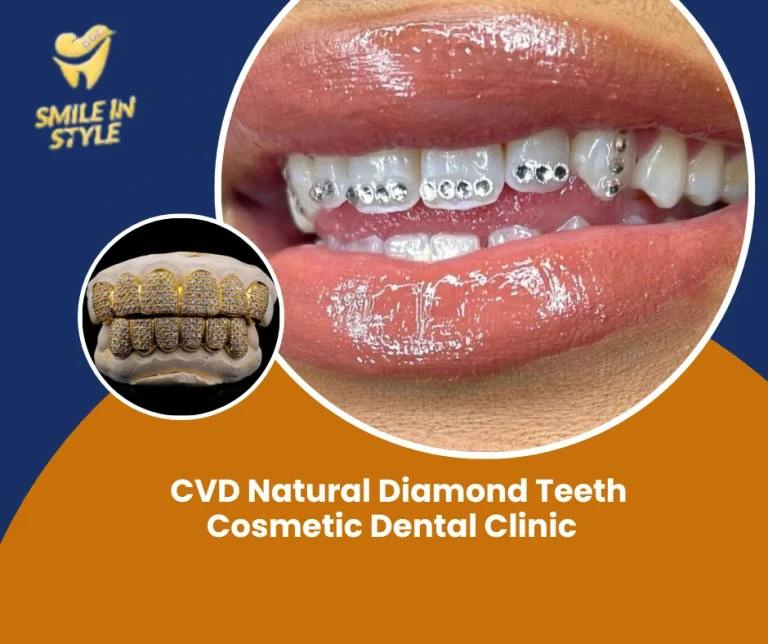 CVD-Natural-Diamond-Teeth