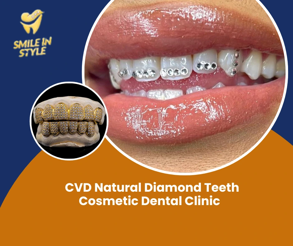 CVD-Natural-Diamond-Teeth