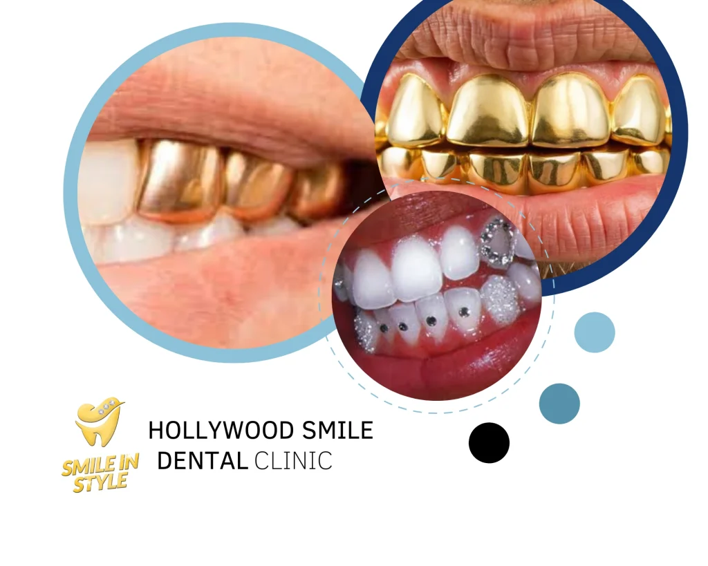 Hollywood smile gold teeth