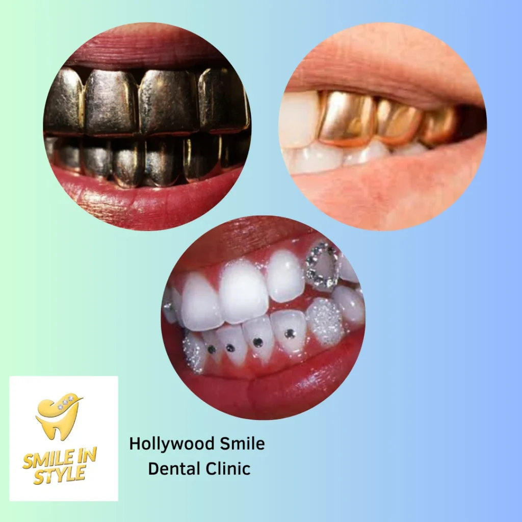 Hollywood smile diamond teeth