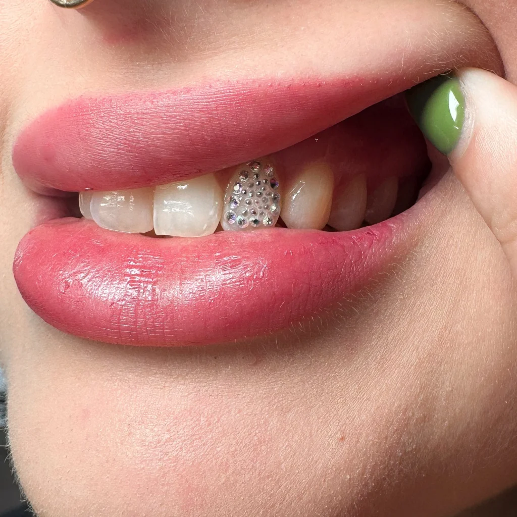 dental art trends in 2025