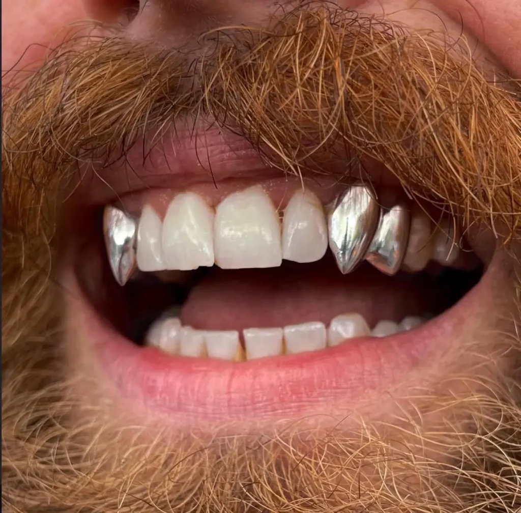 Grillz Styles in 2025