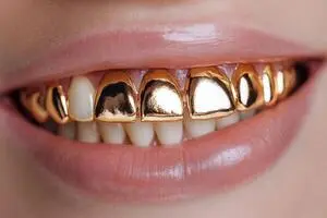 dental art trends in 2025