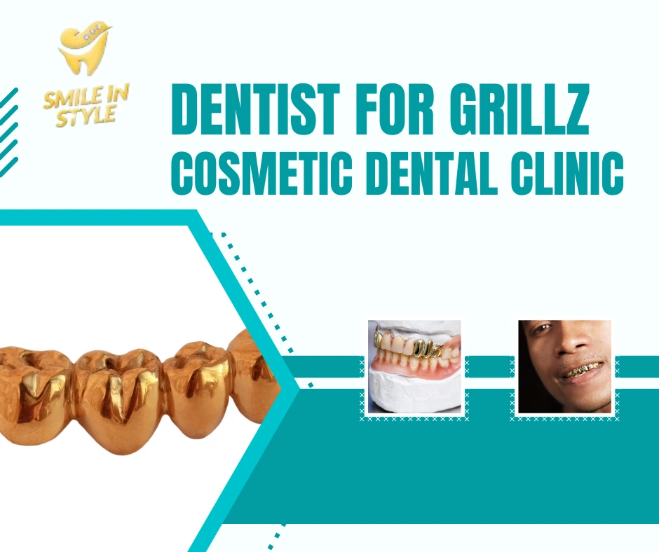 gold vs silver grillz