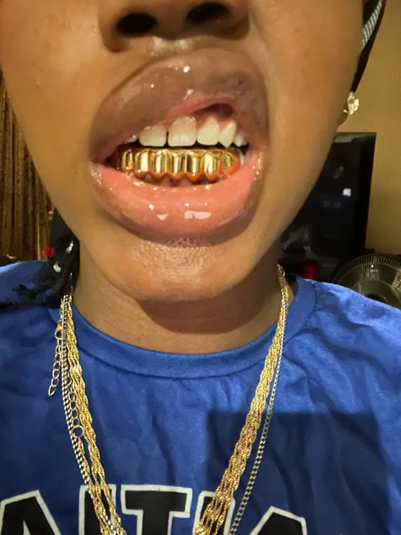 luxury grillz UAE