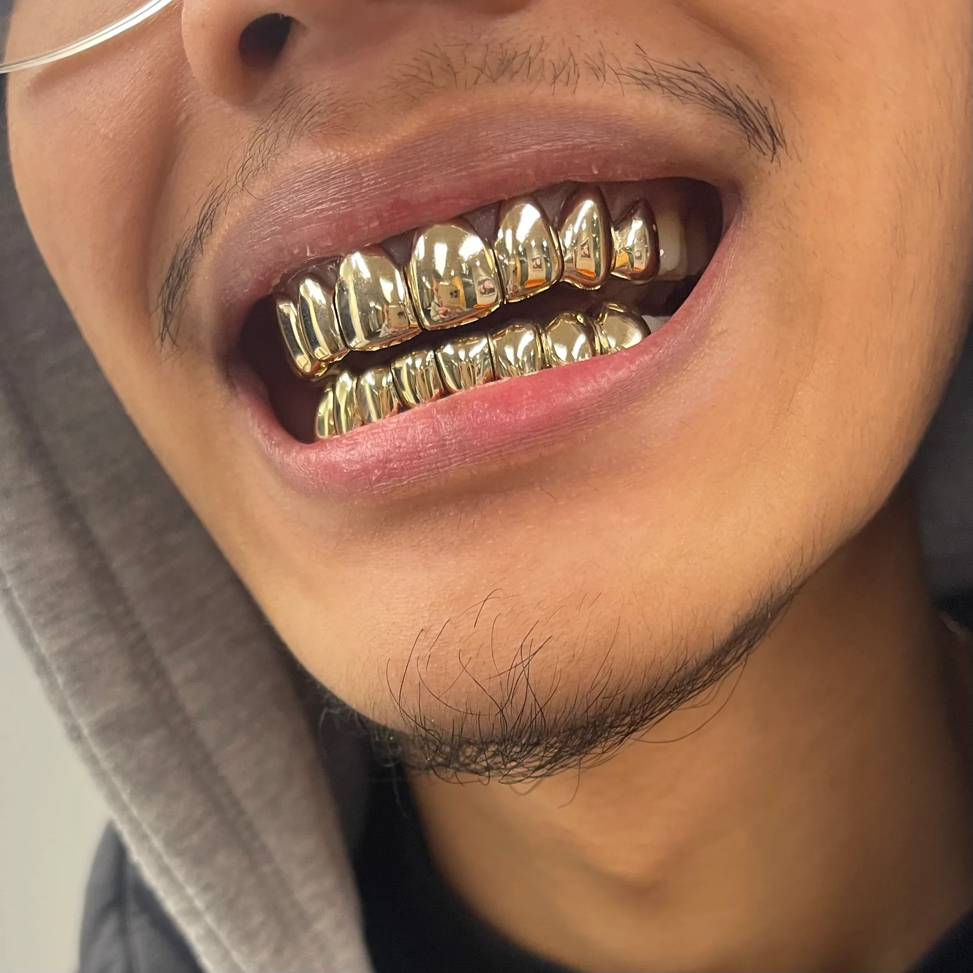 Dentist vs Jeweler for Grillz