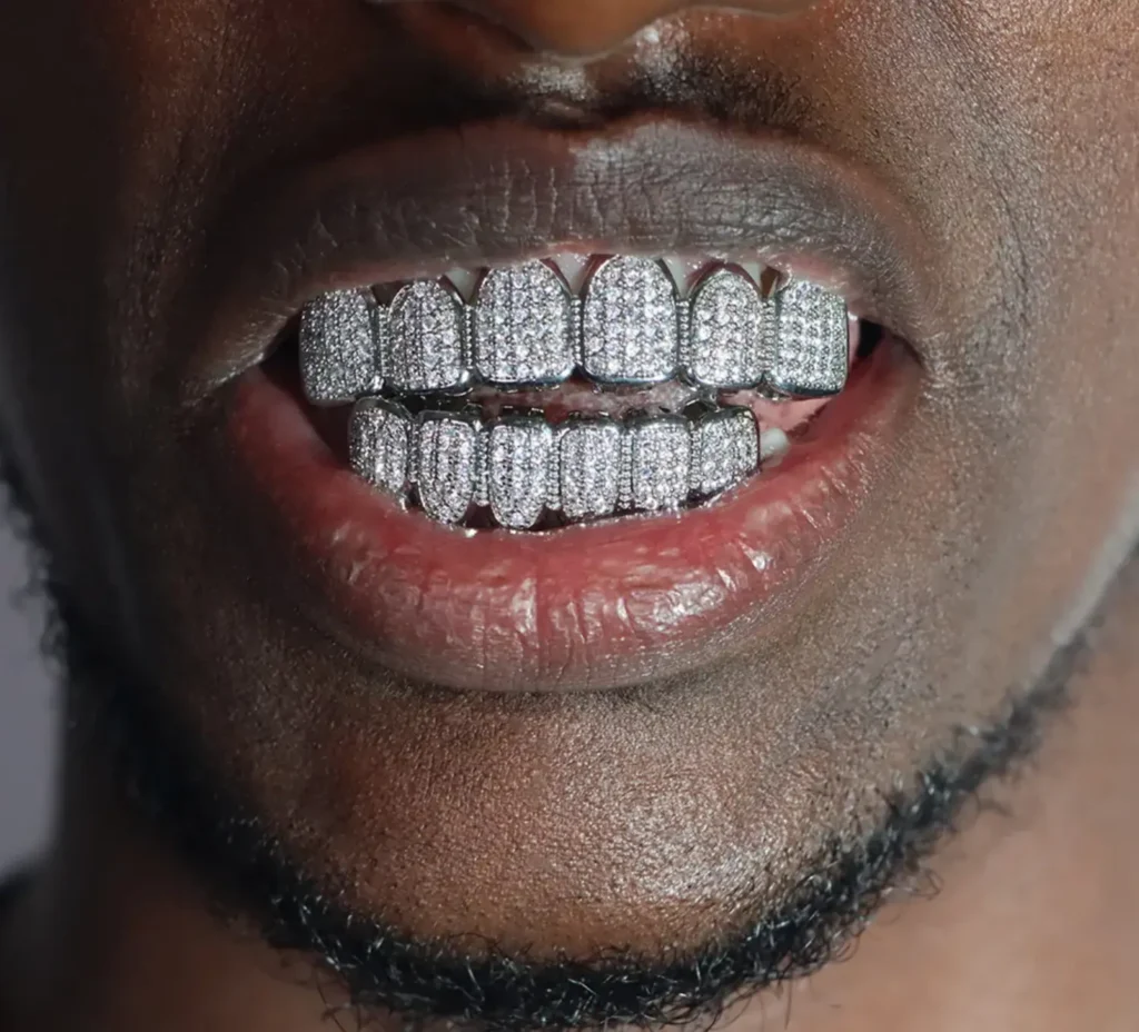 Grillz Dubai The Rise of Grillz Culture in a New Luxury Trend