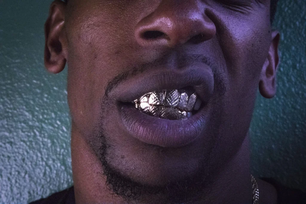Grillz Dubai The Rise of Grillz Culture in a New Luxury Trend
