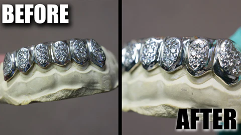 clean gold grillz