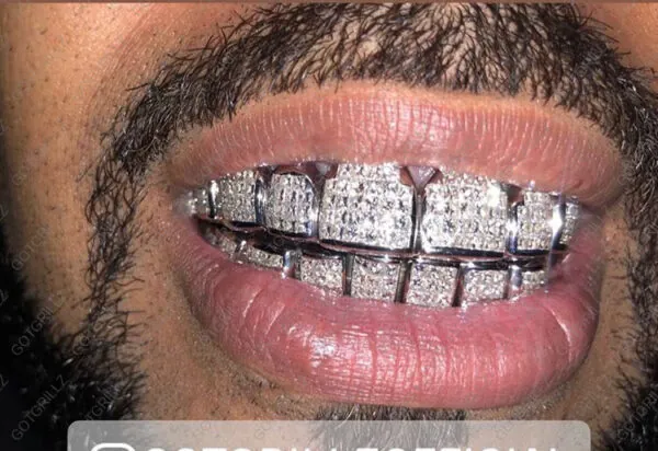 peremmanent diamond grillz