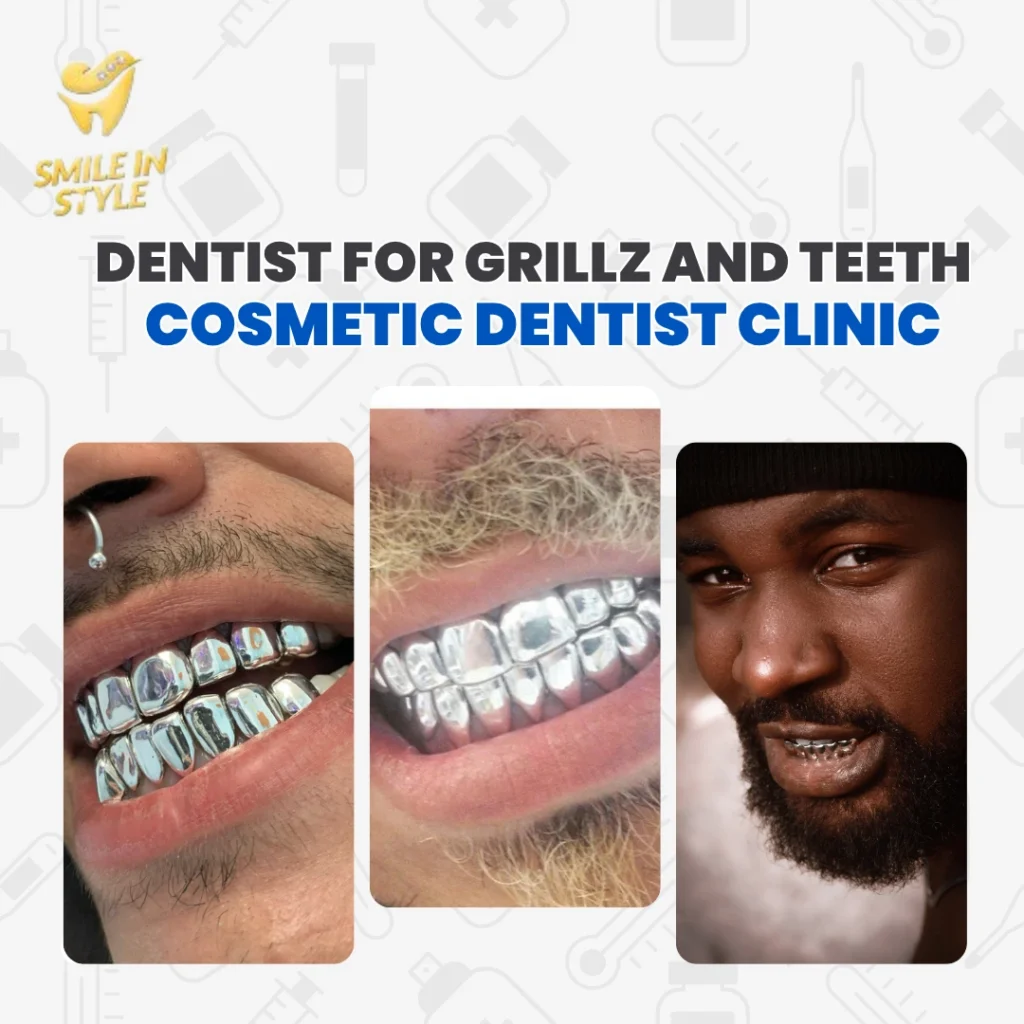 gold vs silver grillz