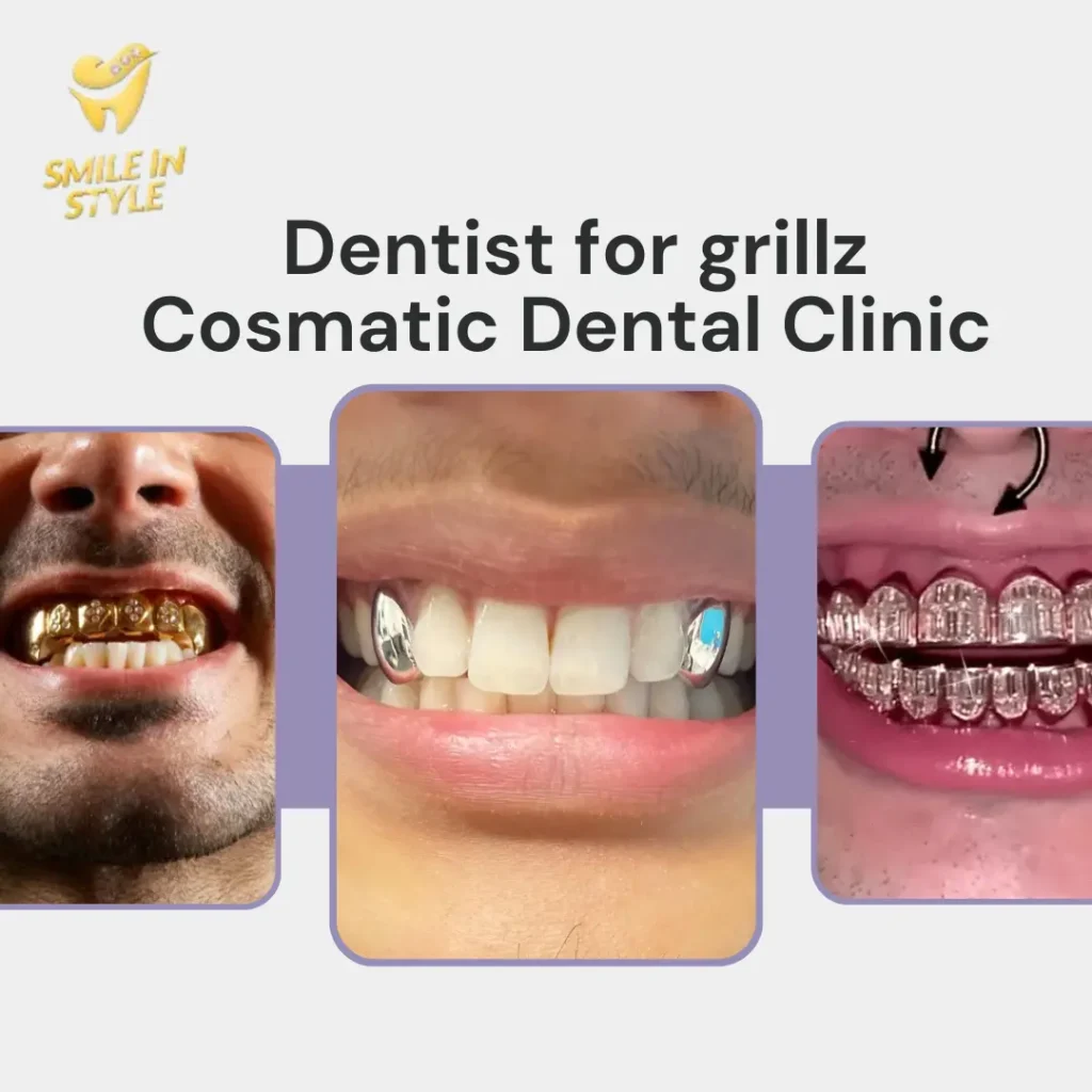 Best Materials for Grillz