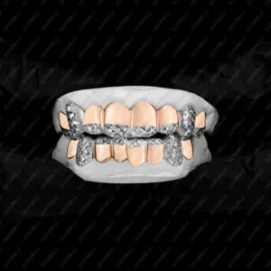 American vs Middle Eastern Grillz