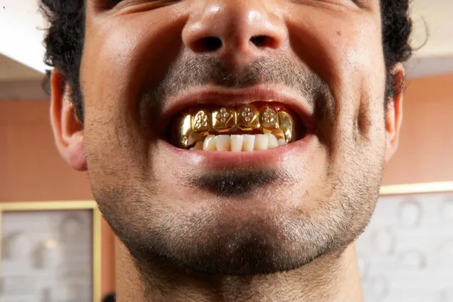 Best Grillz Materials 2025