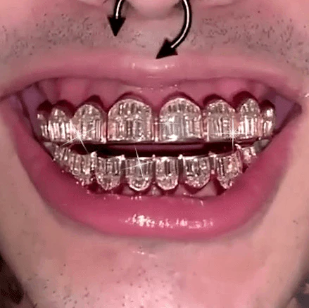 Best Grillz Materials 2025