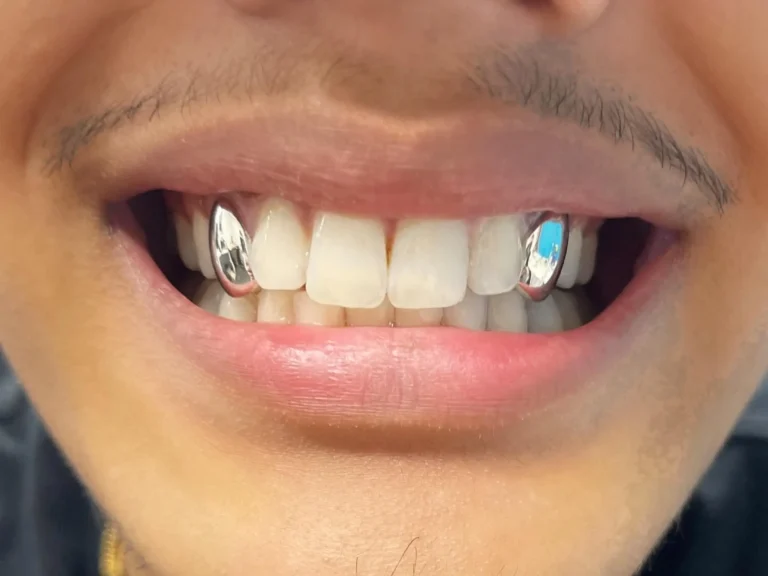 Best Grillz Materials 2025