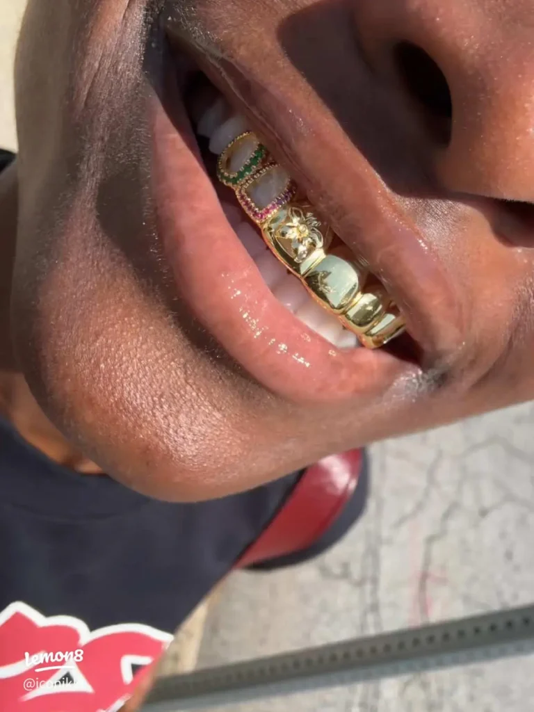 Grillz Confidence