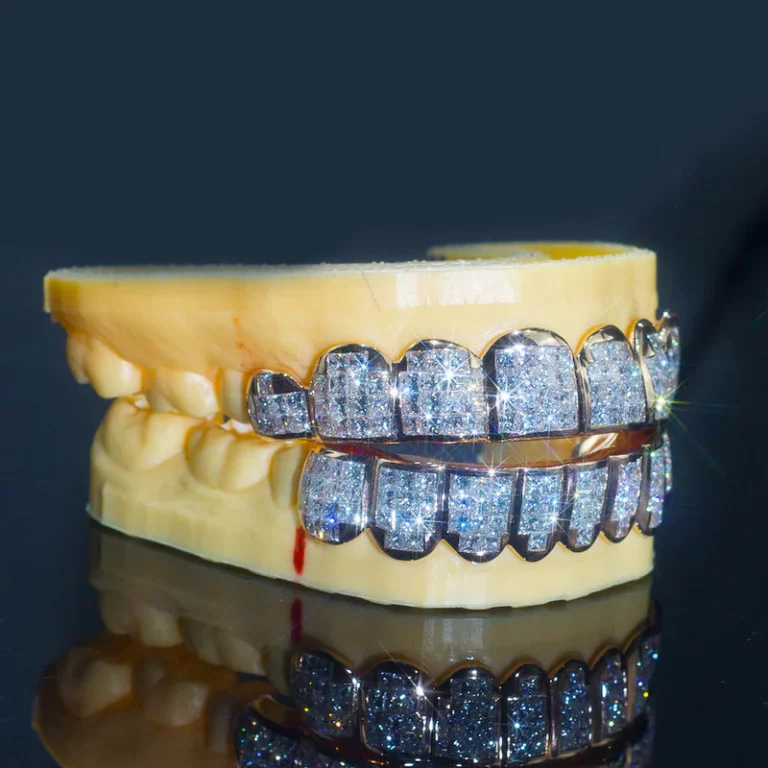 Diamond vs Gemstone Grillz The Battle of Brilliance in 2025