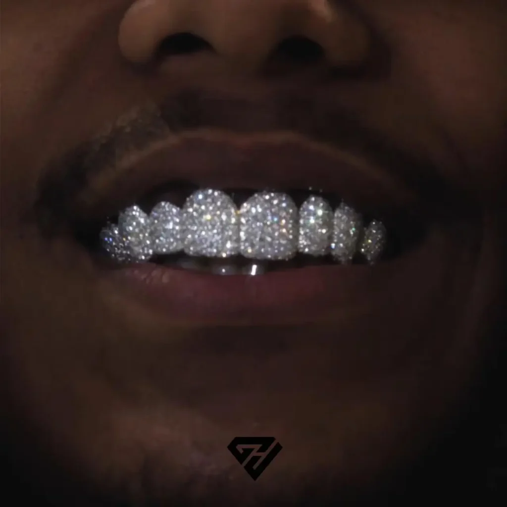 millennials grillz trend