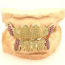 Diamond vs Gemstone Grillz