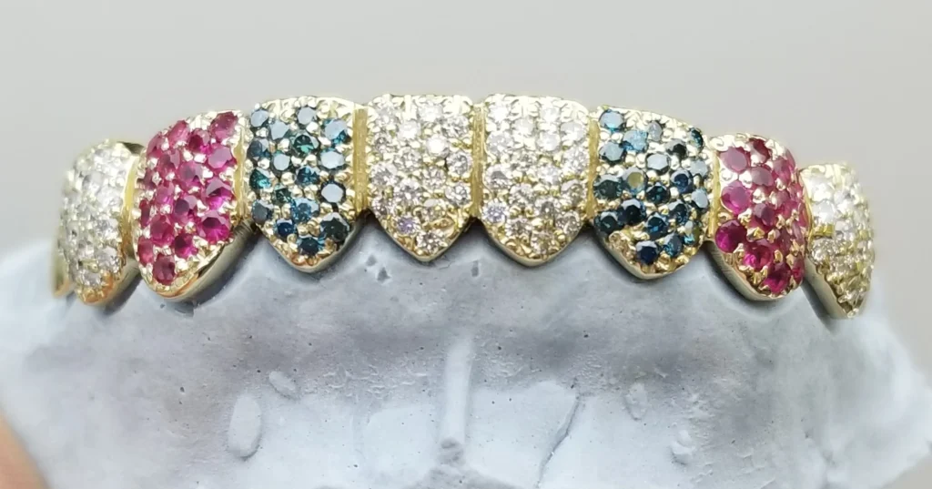 Diamond vs Gemstone Grillz