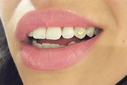 Grillz Dental Care