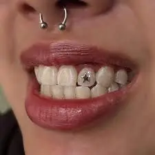millennials grillz trend