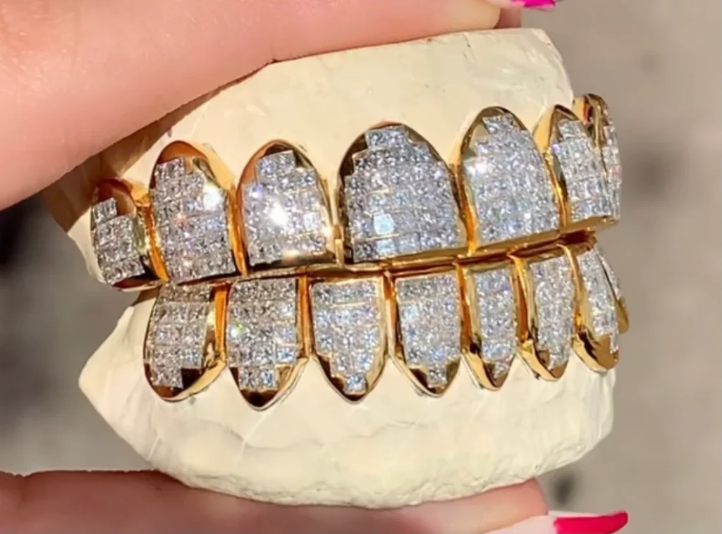 royal grillz