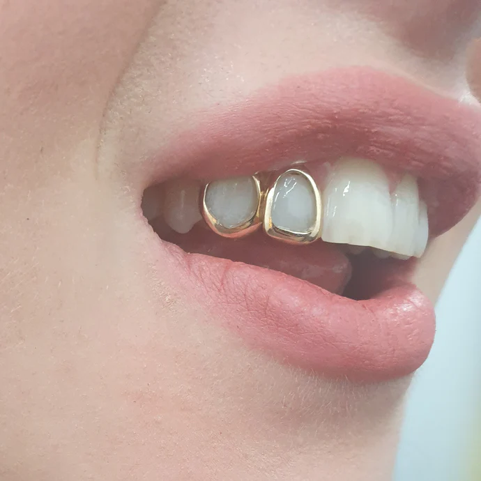 royal grillz