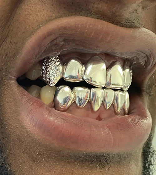 Voice Grillz