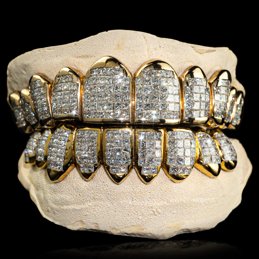 royal grillz