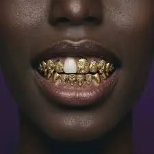 history of gold teeth