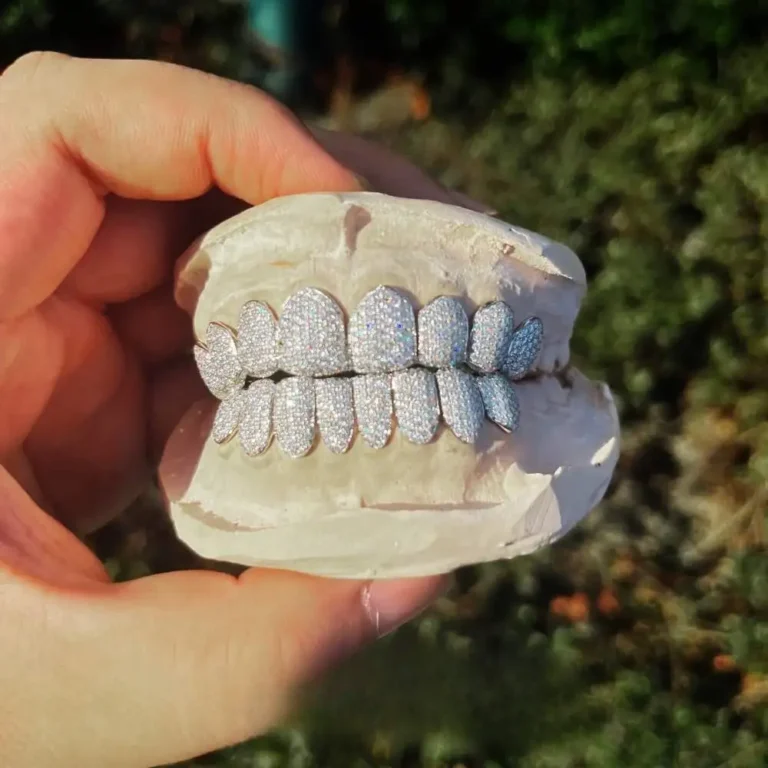 Custom Grillz teeth