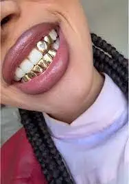 Global Grillz Trend