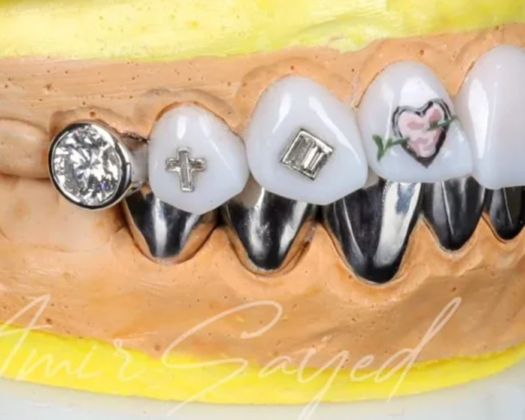 how to keep gold grillz shiny