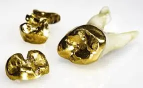 history of gold teeth