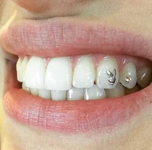 Dental Twinkle and Gems