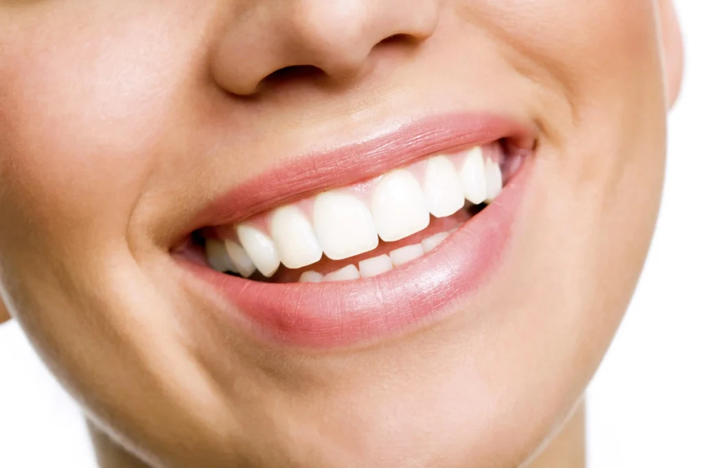 Teeth Whitening in Dubai
