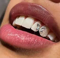 Tooth Jewelry in UAE