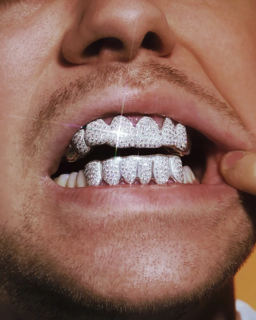 custom grillz UAE