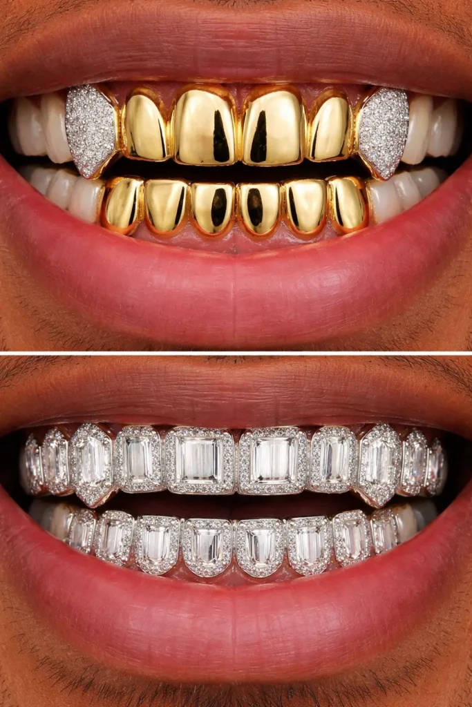 professional fixed grillz