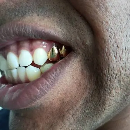 gold wedding grillz