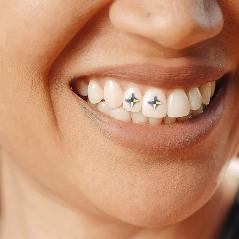 Tooth Jewelry in UAE
