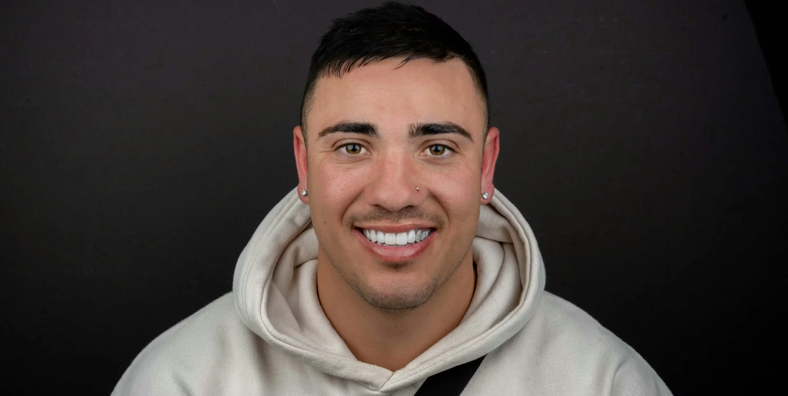 luxury diamond veneers