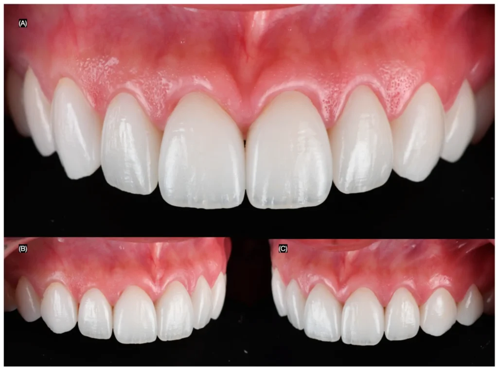 Artistic Smile Enhancements