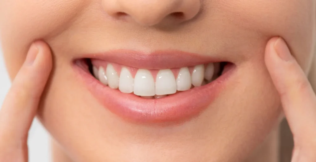 safe teeth whitening treatment